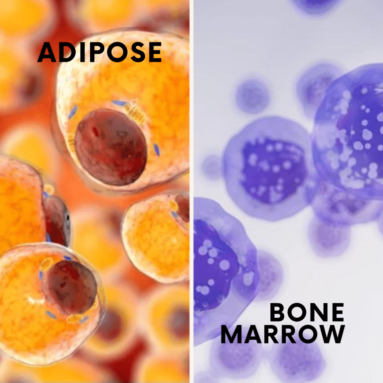 Adipose-Derived Stem Cells vs. Bone Marrow Stem Cells: What's the Difference?