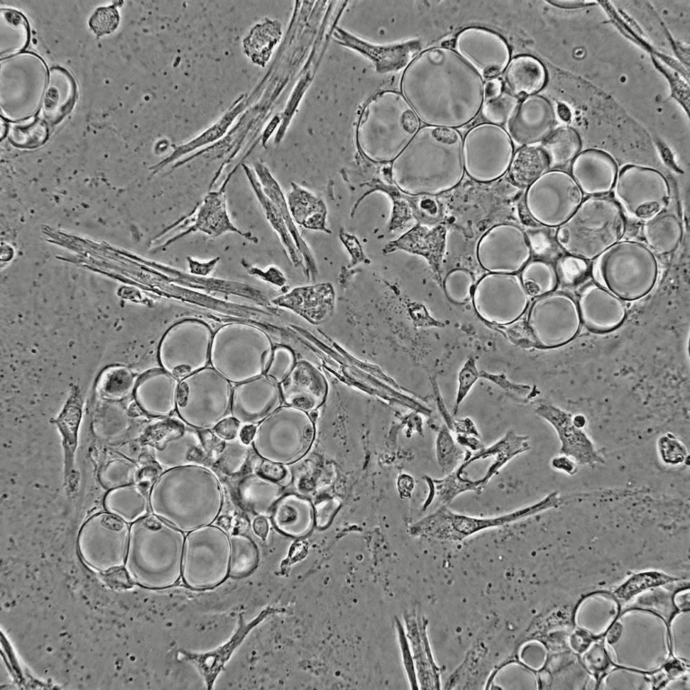Microfragmented Adipose Tissue (MFAT): How It Works, Where It Is Being Studied, and What Patients Should Watch For