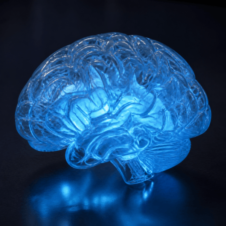 Multiple System Atrophy shown on a translucent blue anatomical model of a brain