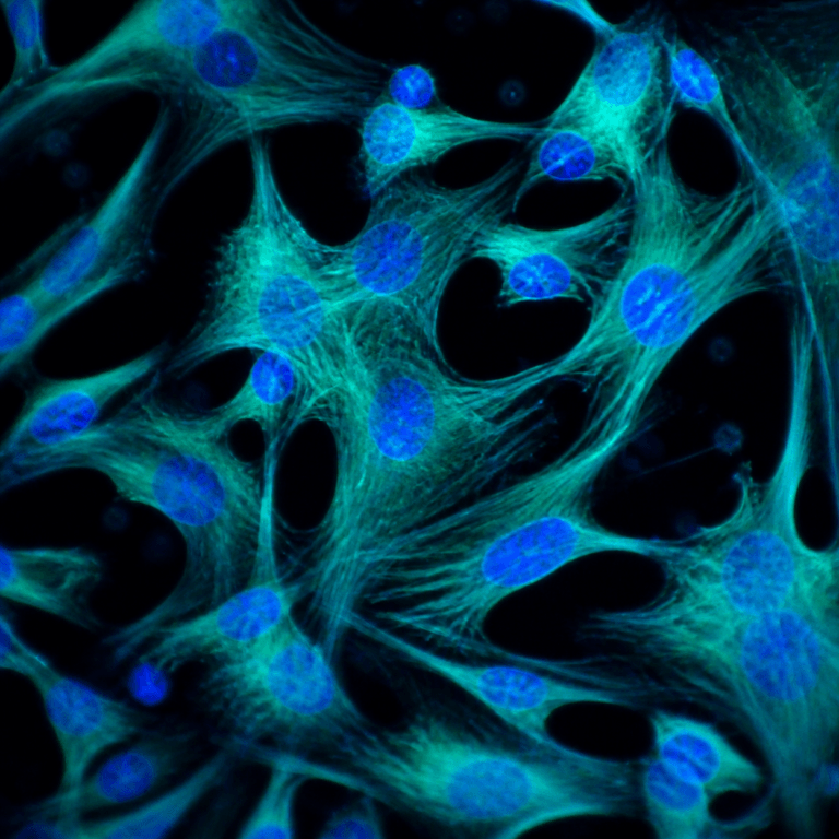 Trilineage Differentiation seen in fluorescence microscopy of cultured cells